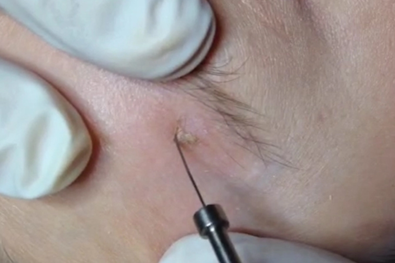 onetec® von Diotima Kosmetikinstitut