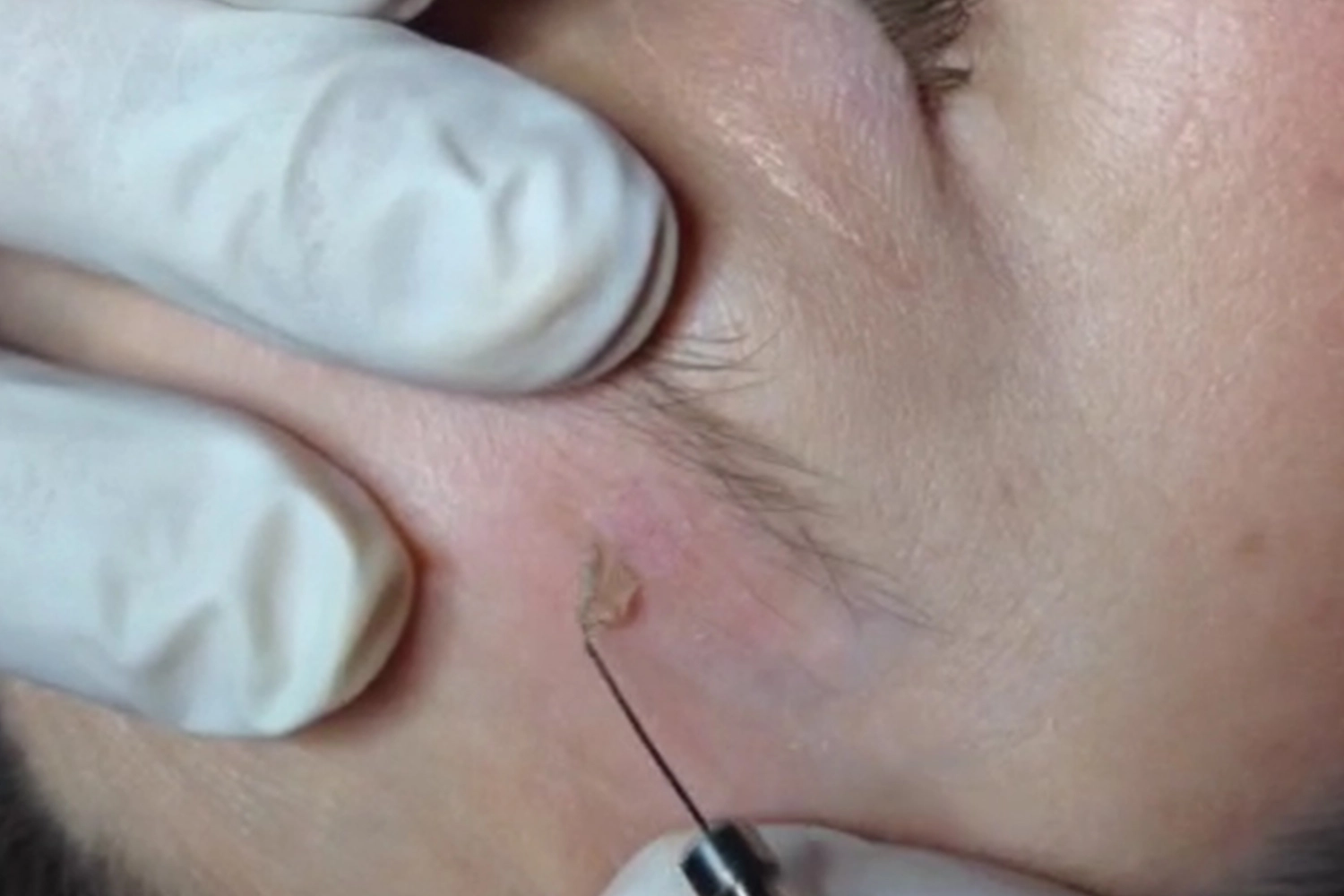 onetec® von Diotima Kosmetikinstitut