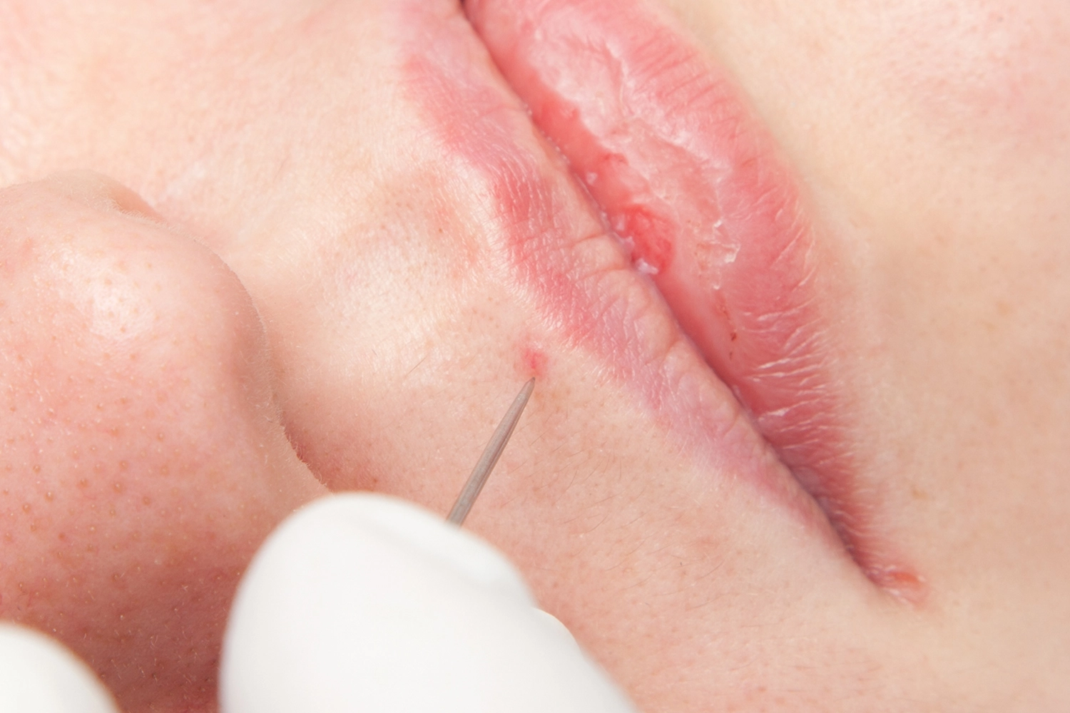 onetec® von Diotima Kosmetikinstitut