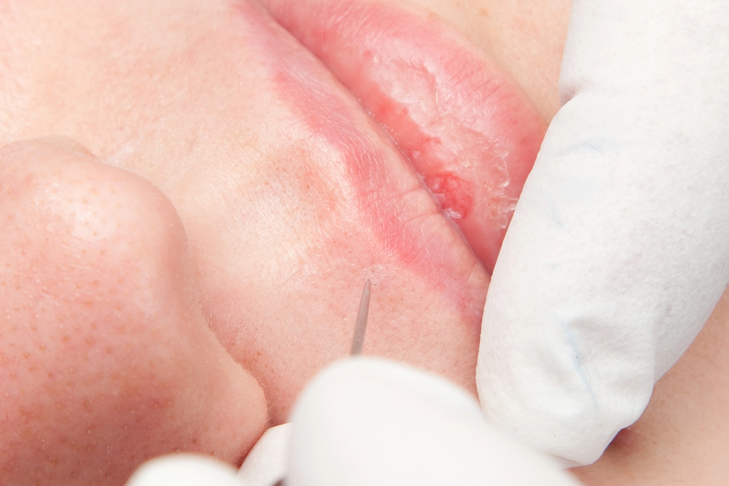 onetec® von Diotima Kosmetikinstitut