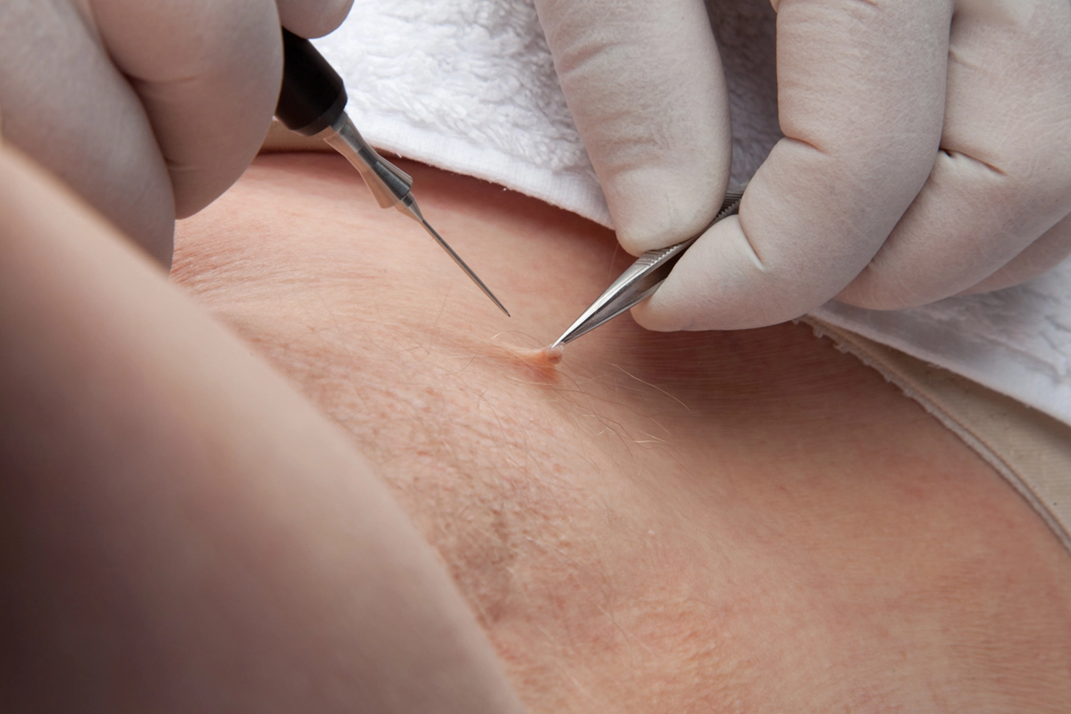 onetec® von Diotima Kosmetikinstitut