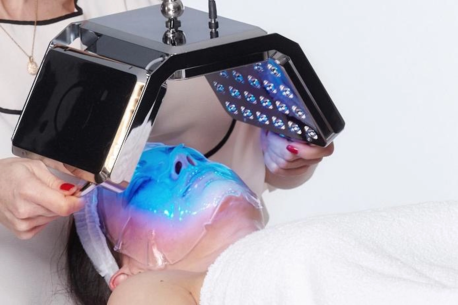 Micro-Needling von Diotima Kosmetikinstitut