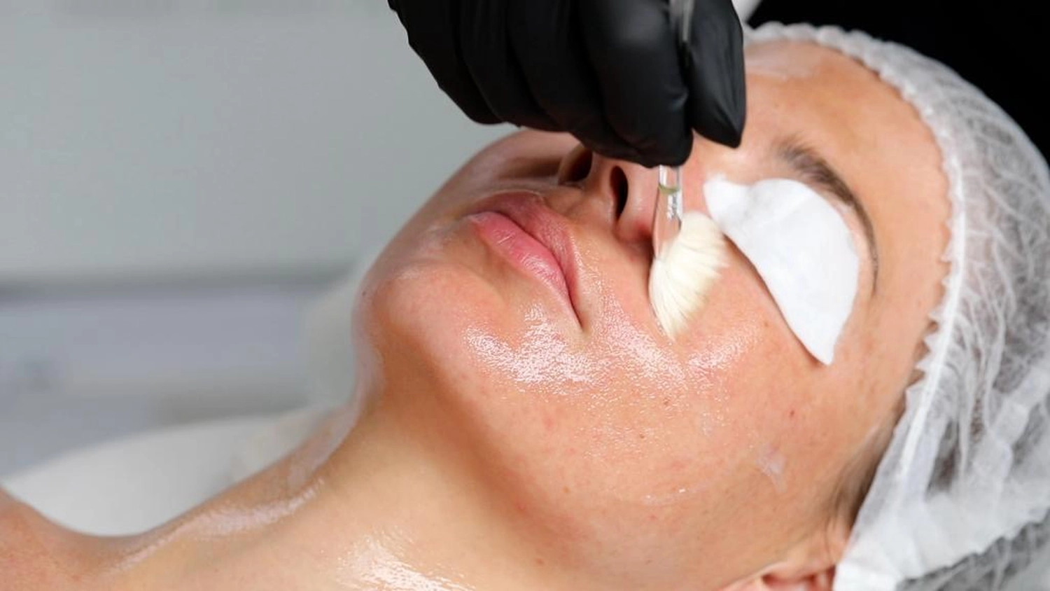 Fruchtsäure - Peeling von Diotima Kosmetikinstitut